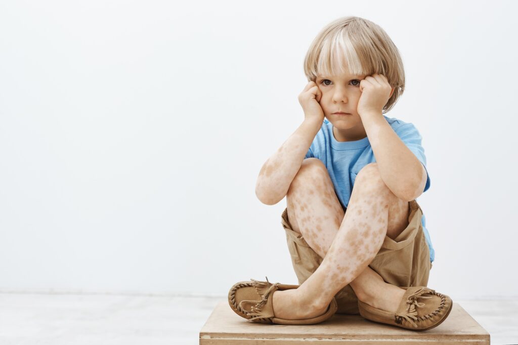 Little boy feeling gloomy being not like every other child. Unhappy cute blond child sitting with cr